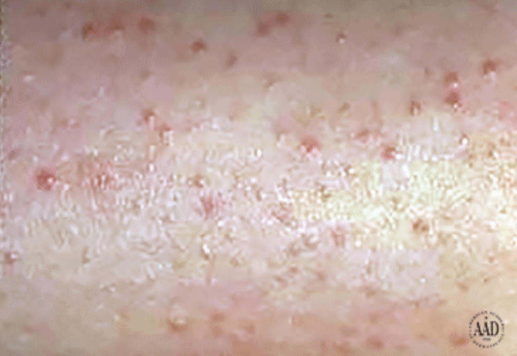 A close-up of bumpy skin