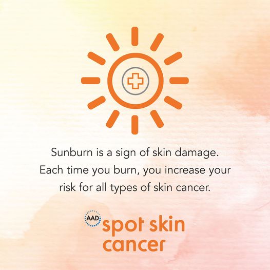 Spot Skin Cancer